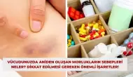 Vücudunuzda Aniden Oluşan Morlukların Sebepleri Neler? Dikkat Edilmesi Gereken Önemli İşaretler!