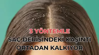 Saç Derinizi 3 Yöntemle Temizleyin: Saçtaki Kaşıntıyı Bitirecek Tavsiyeler