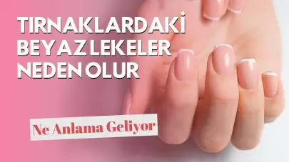 Tırnaklardaki Beyaz Lekeler Neden Olur? Ne Anlama Geliyor