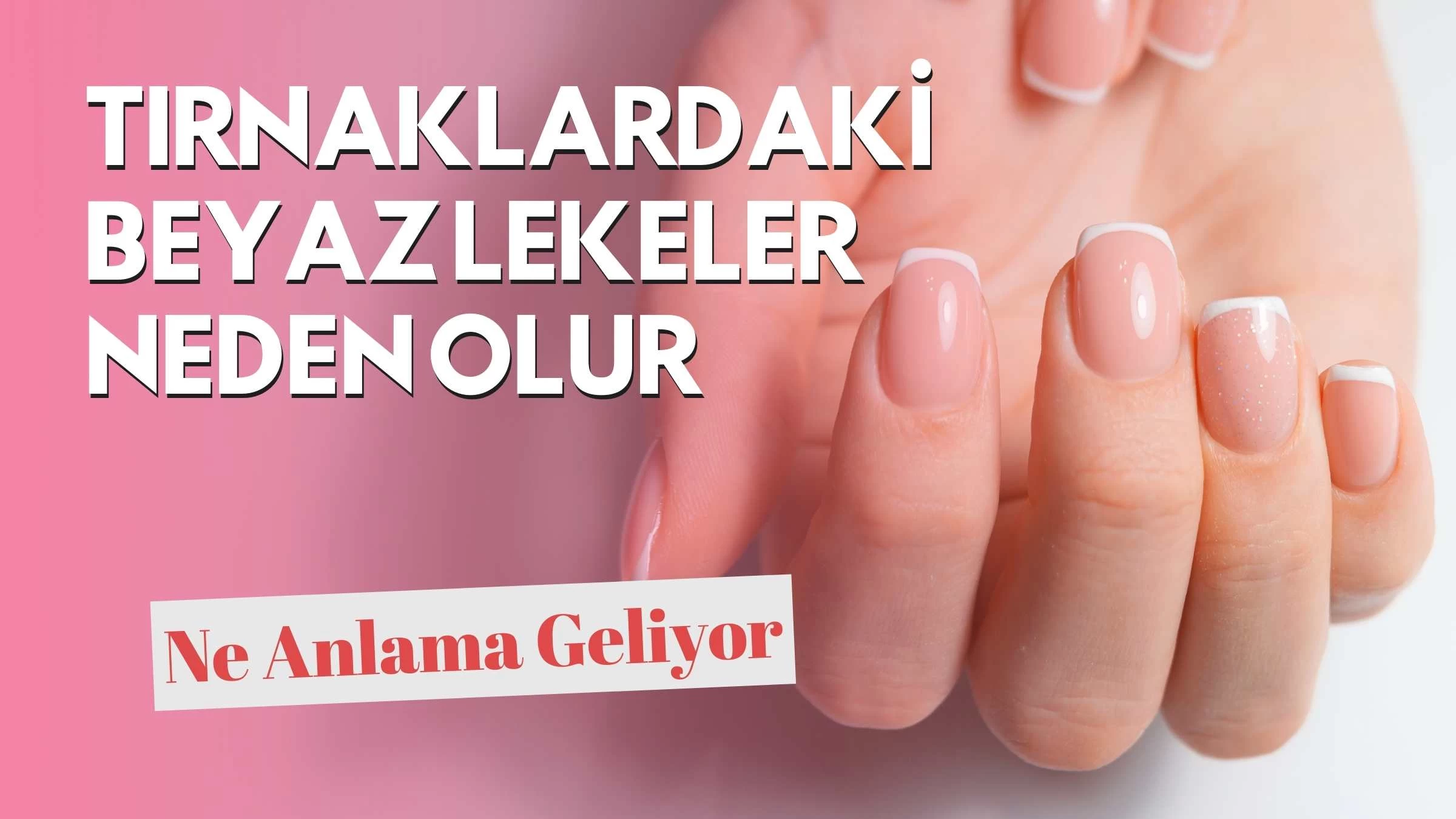 Tırnaklardaki Beyaz Lekeler Neden Olur? Ne Anlama Geliyor